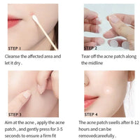 72-720Pcs Invisible Acne Patches Removal Pimple Anti-Acne Hydrocolloid Patches Spots Marks Concealer Repair Sticker Waterproof